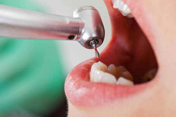 Best Holiday Emergency Dentist in Morristown, TN